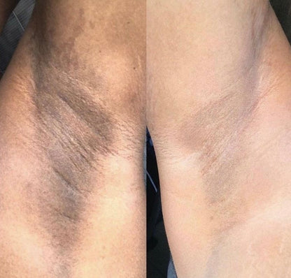 SLAY BODY CARE 4 in 1 Set