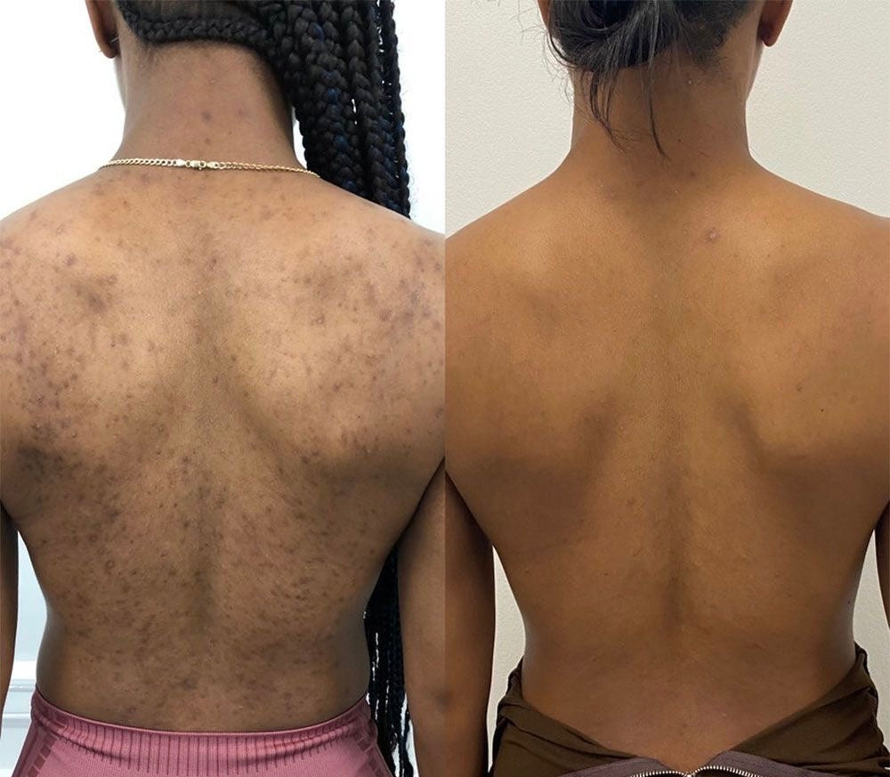 JUST SLAY BODY CARE 4 in 1 Set